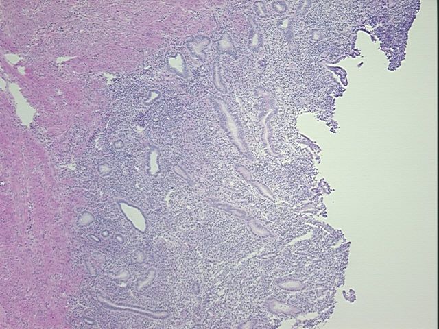 4x Image
