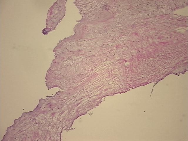 4x Image