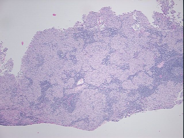 4x Image