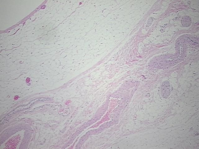 4x Image
