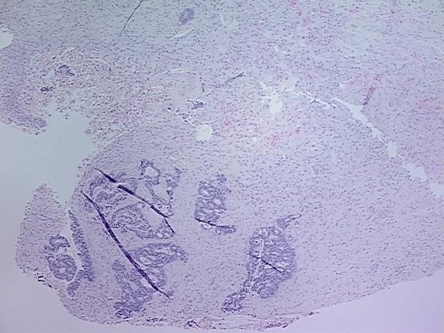 4x Image