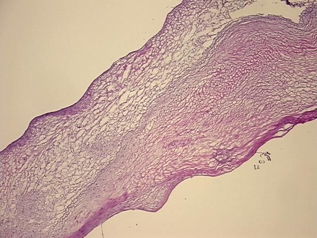 4x Image
