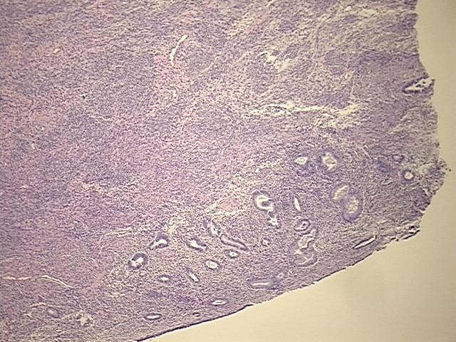 4x Image