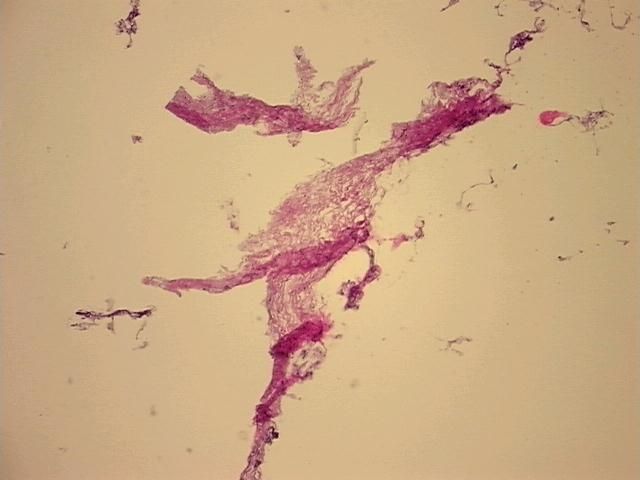 4x Image