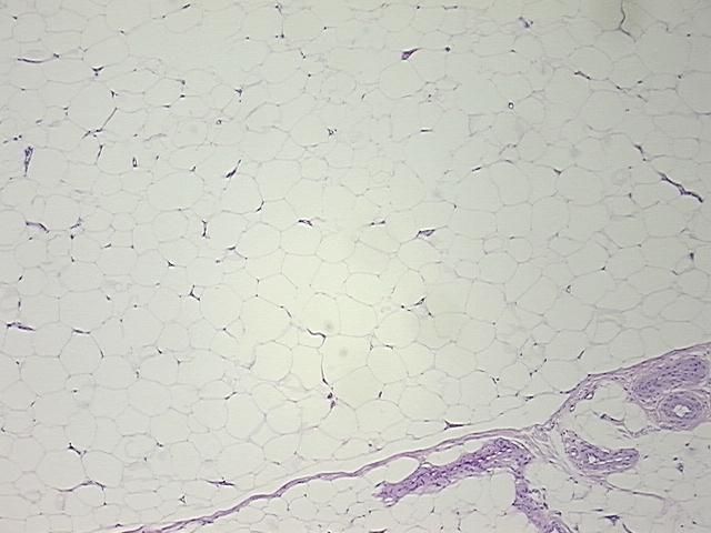 4x Image