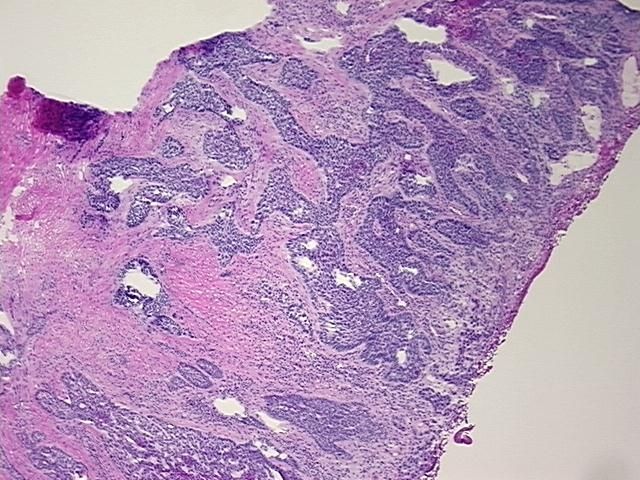 4x Image