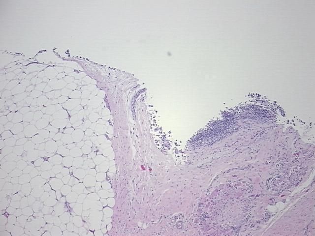 4x Image