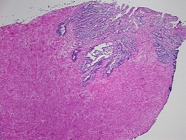 4x Image
