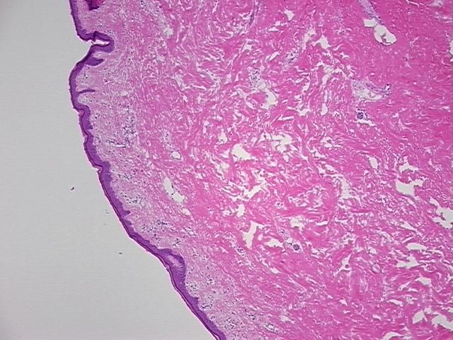 4x Image