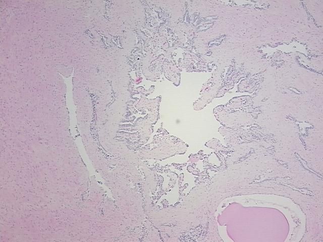 4x Image