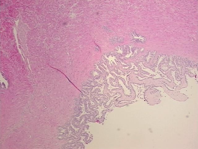 4x Image