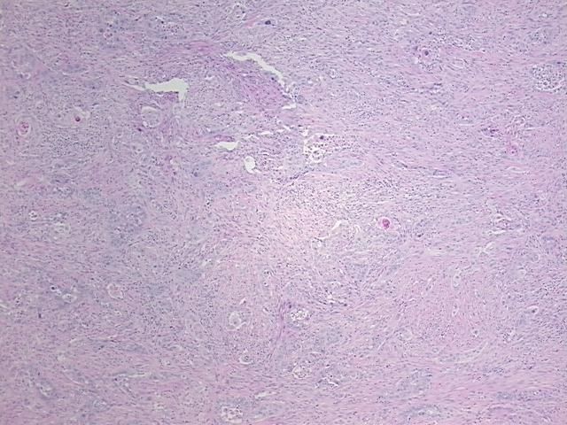 4x Image