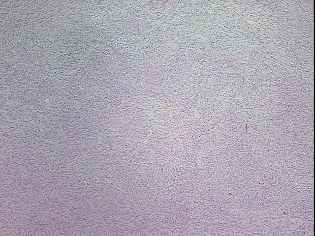 4x Image