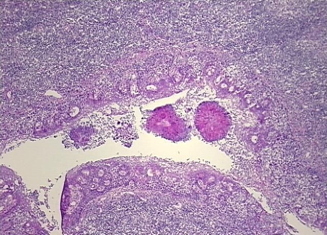 4x Image