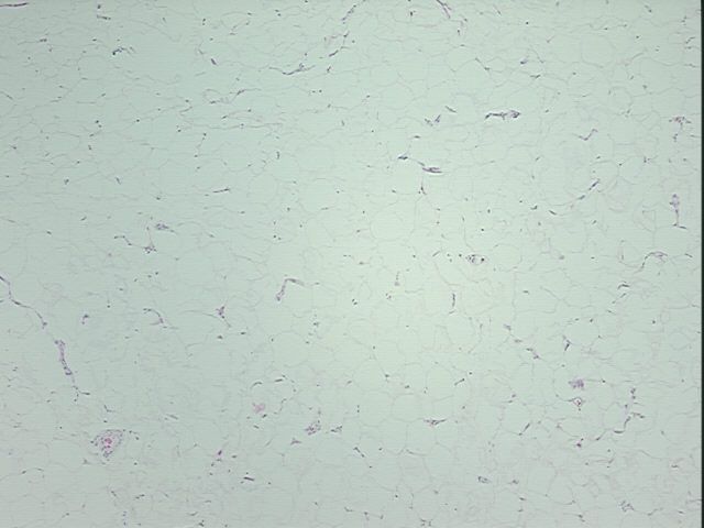 4x Image