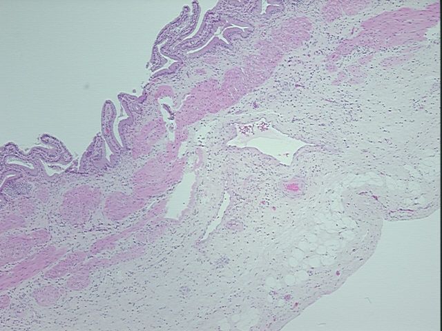 4x Image