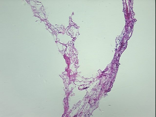 4x Image
