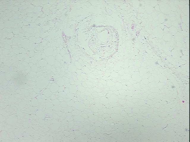 4x Image