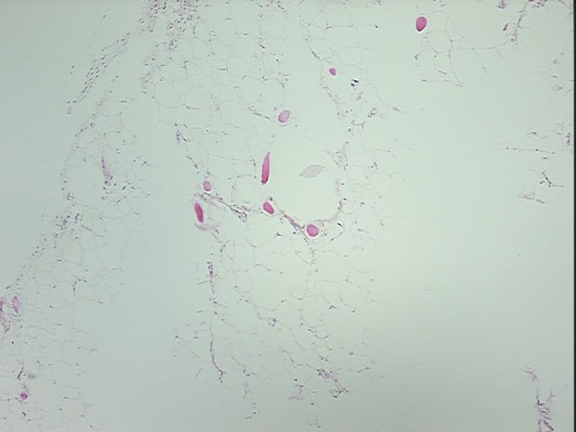 4x Image