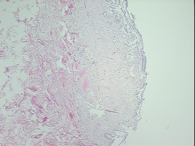 4x Image
