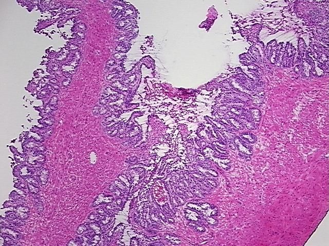 4x Image
