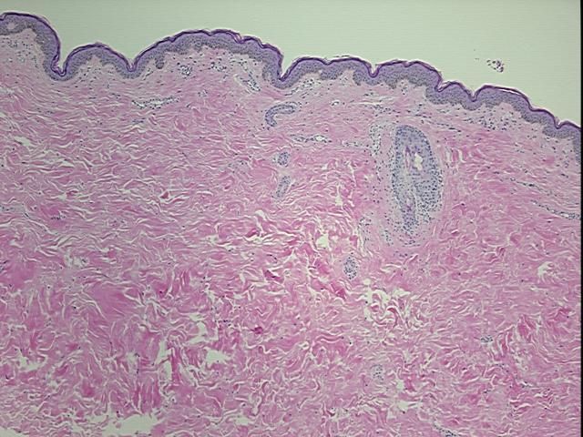 4x Image