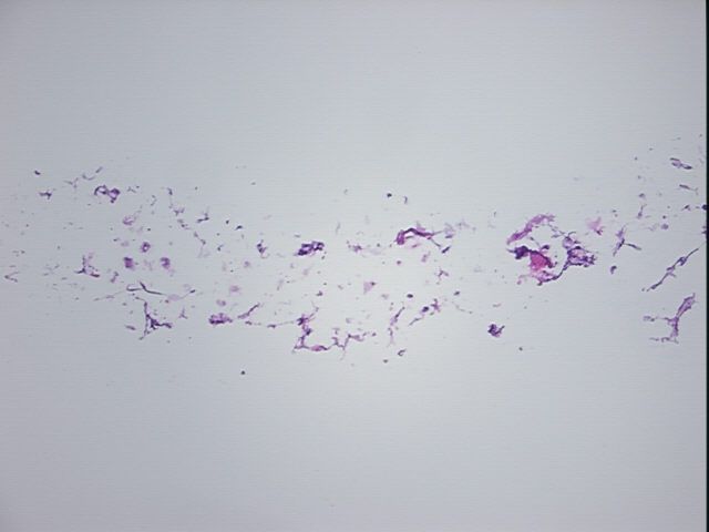 4x Image