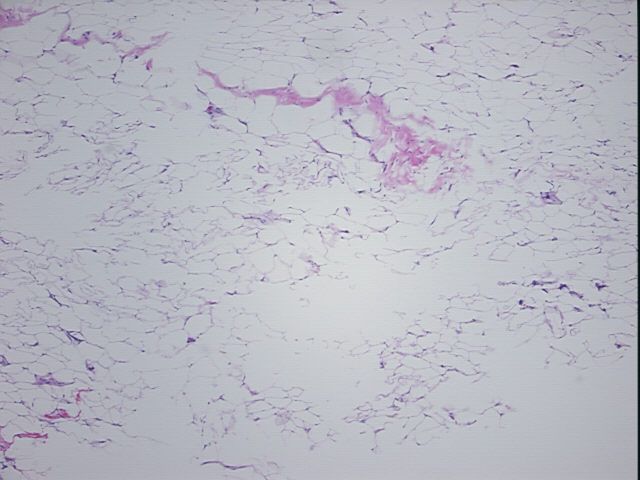4x Image