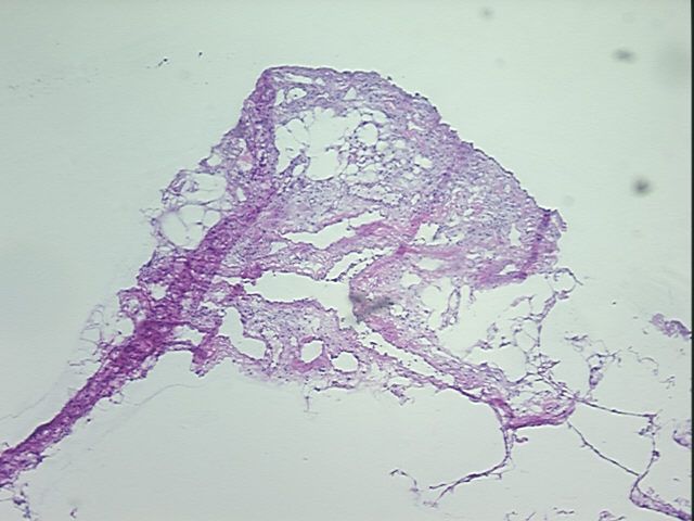 4x Image