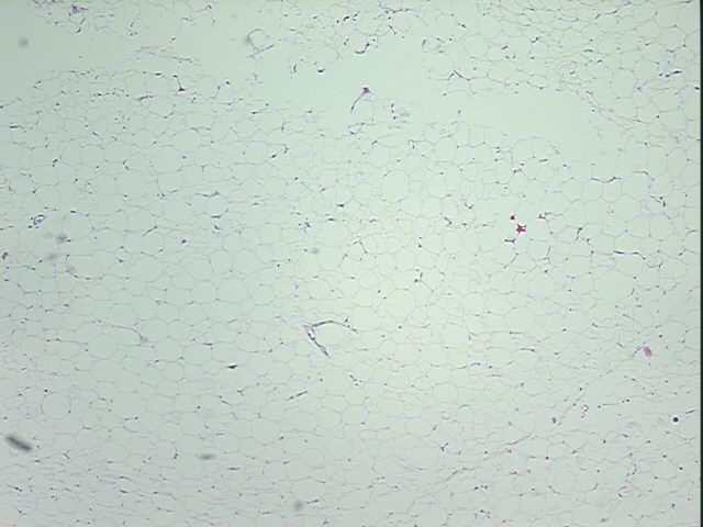 4x Image