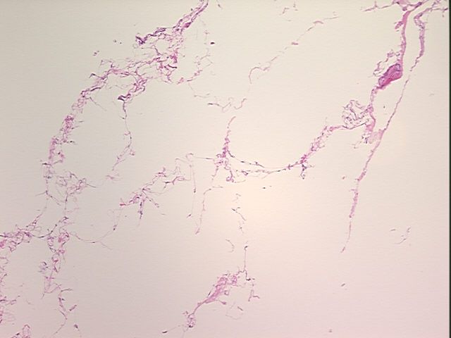 4x Image