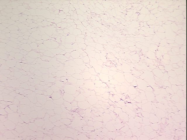 4x Image