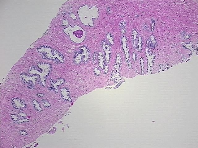 4x Image