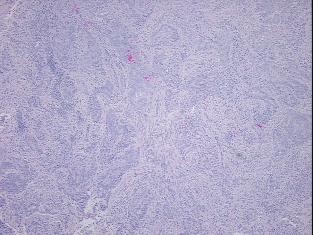 4x Image