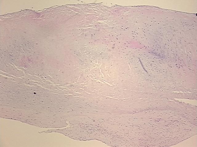 4x Image