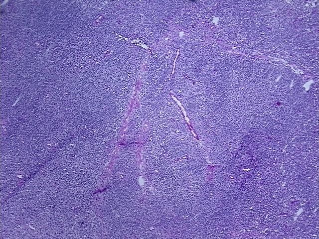 4x Image