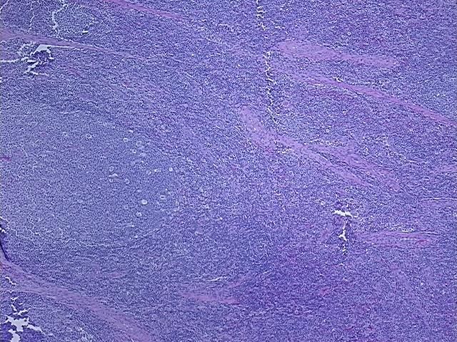 4x Image