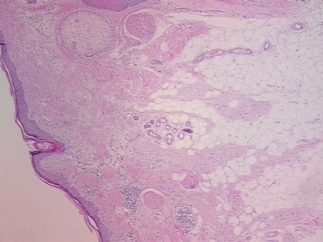 4x Image