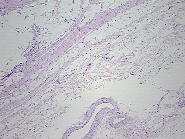 4x Image