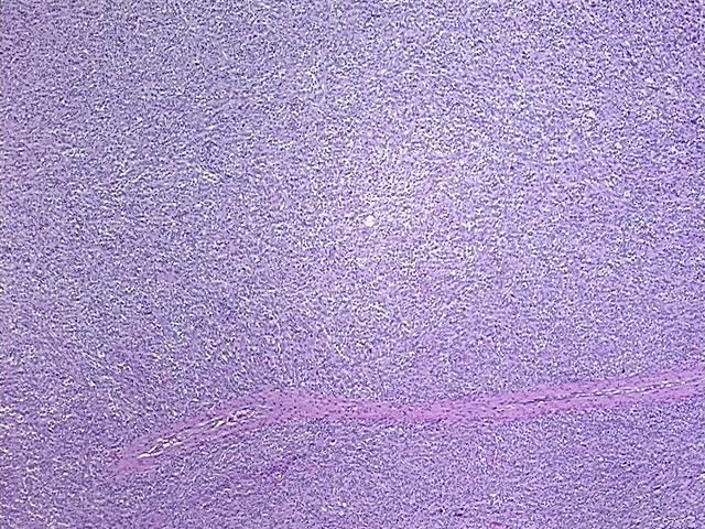 4x Image
