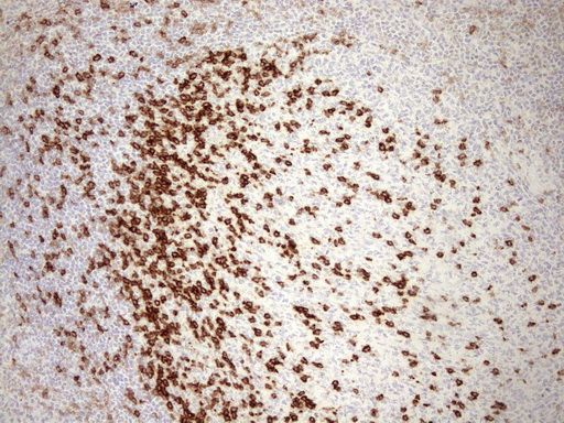 Immunohistochemical staining of paraffin-embedded Human tonsil using anti-PDCD1 mouse monoclonal antibody. (Heat-induced epitope retrieval by 1mM EDTA in 10mM Tris buffer (pH8.5) at 110°C for 10min, UM800091) (1:1200)