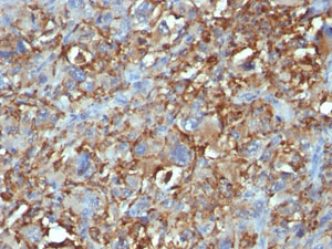 Mouse Anti-CD68 Monoclonal Antibody – Cat# MBS438131
