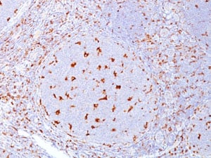 Mouse Anti-CD68 Monoclonal Antibody, Immunohistochemistry (IHC) – Cat# MBS438131