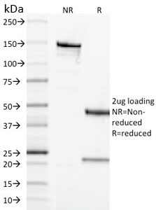 Mouse Anti-CD68 Monoclonal Antibody, SDS-PAGE – Cat# MBS438131