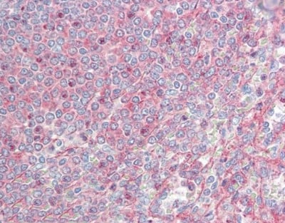 Rabbit Anti-MTCL1 / SOGA2 Polyclonal Antibody – Cat# MBS2400273