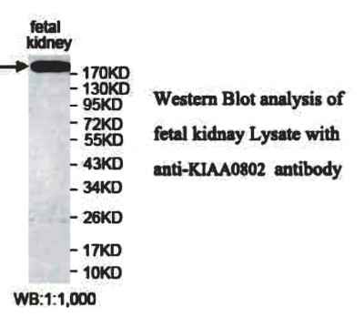 Rabbit Anti-MTCL1 / SOGA2 Polyclonal Antibody, Western Blot (WB) – Cat# MBS2400273