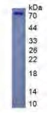 Homo Sapiens (Human) CFTR Recombinant Protein, SDS-Page – Cat# MBS2097537