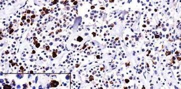 Mouse Anti-Lambda Chain Monoclonal Secondary Antibody – Cat# MBS6122304