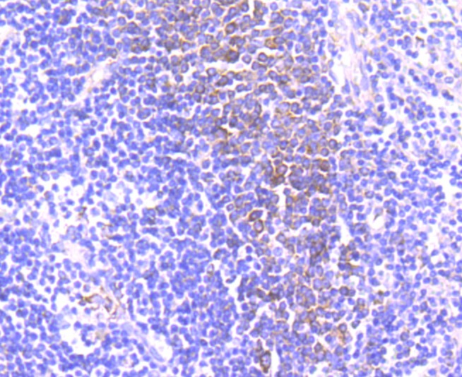 Anti-CD39 Antibody (8G885)