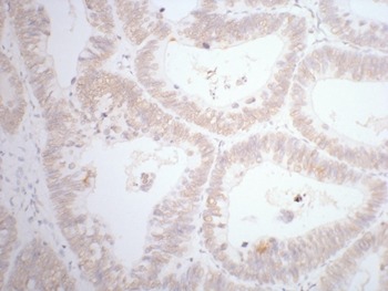 Anti-CDX2 Antibody (1E543)